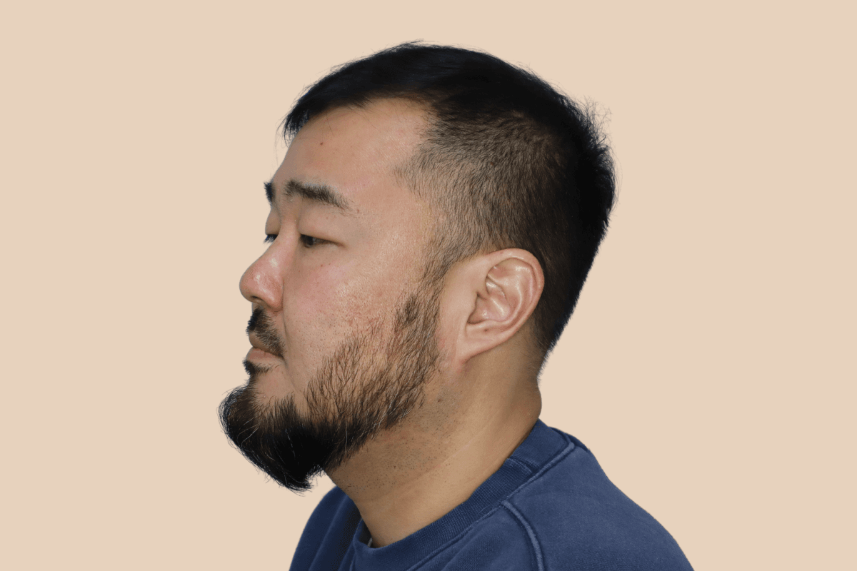구레나룻 턱수염 라인을 또렷하게 디자인한 사례 비포