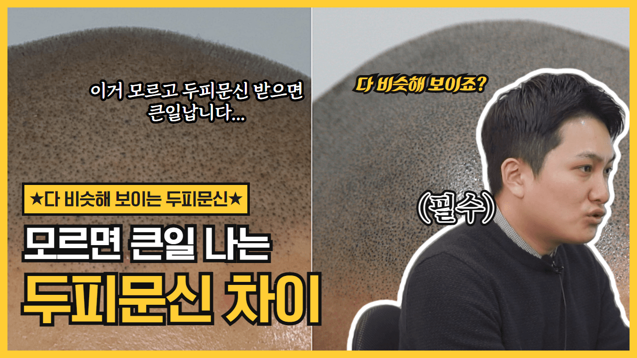 도트락SMP의 시술 기법