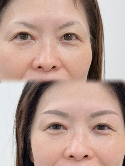 女性の眉 · コンボ 施術写真