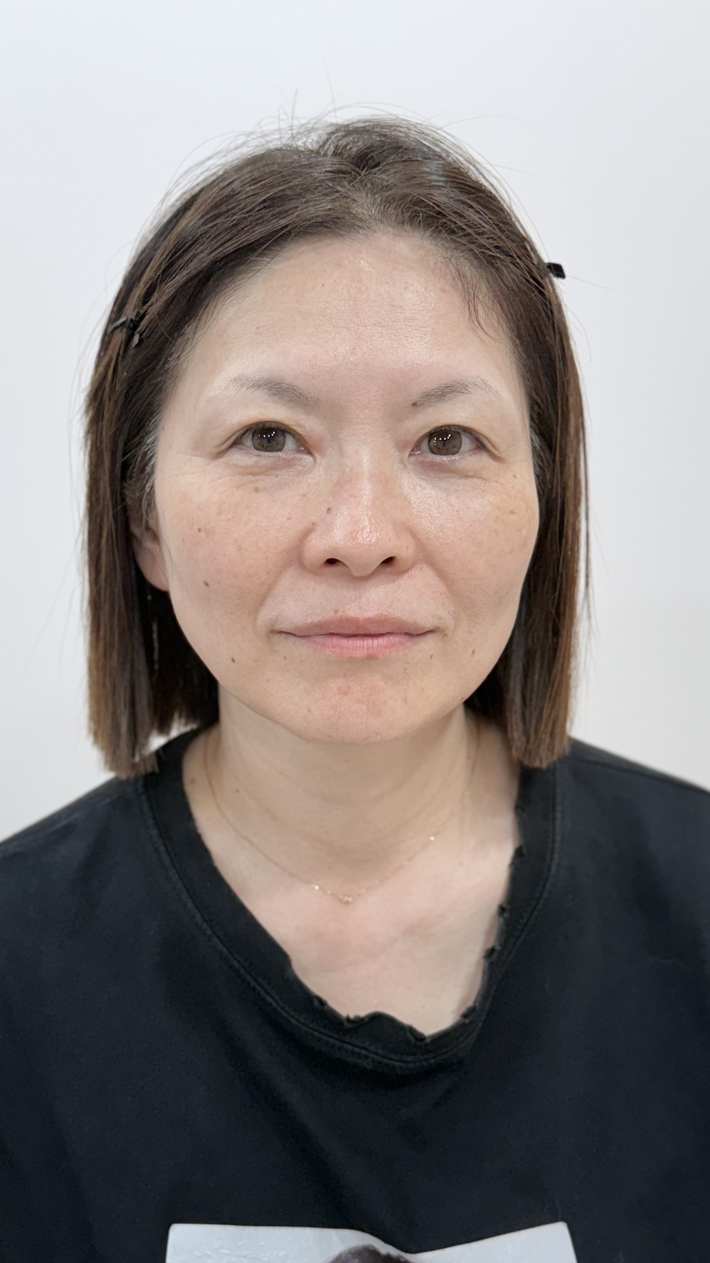 어보브나인 콤보 before