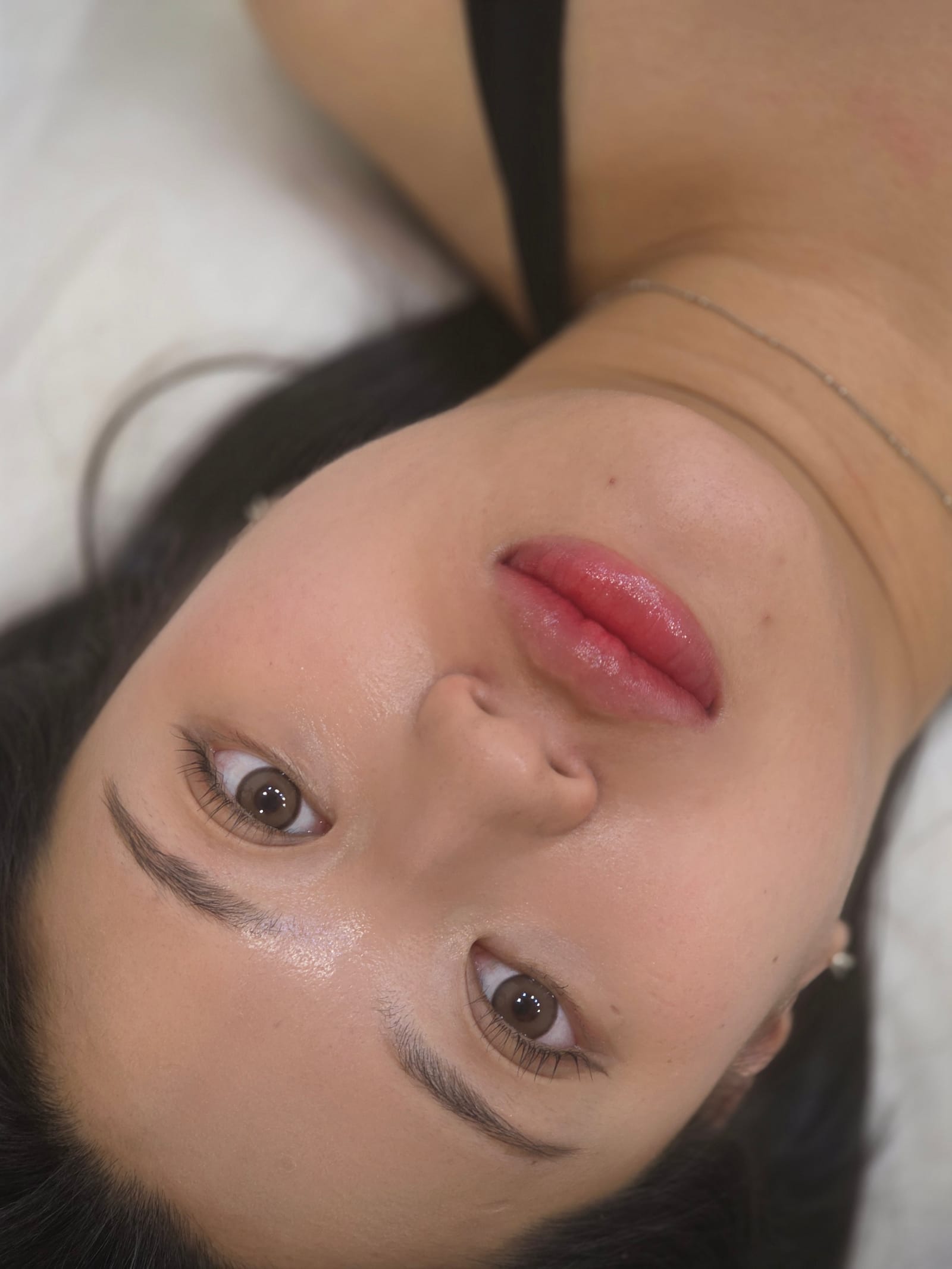 다크립 교정 애프터