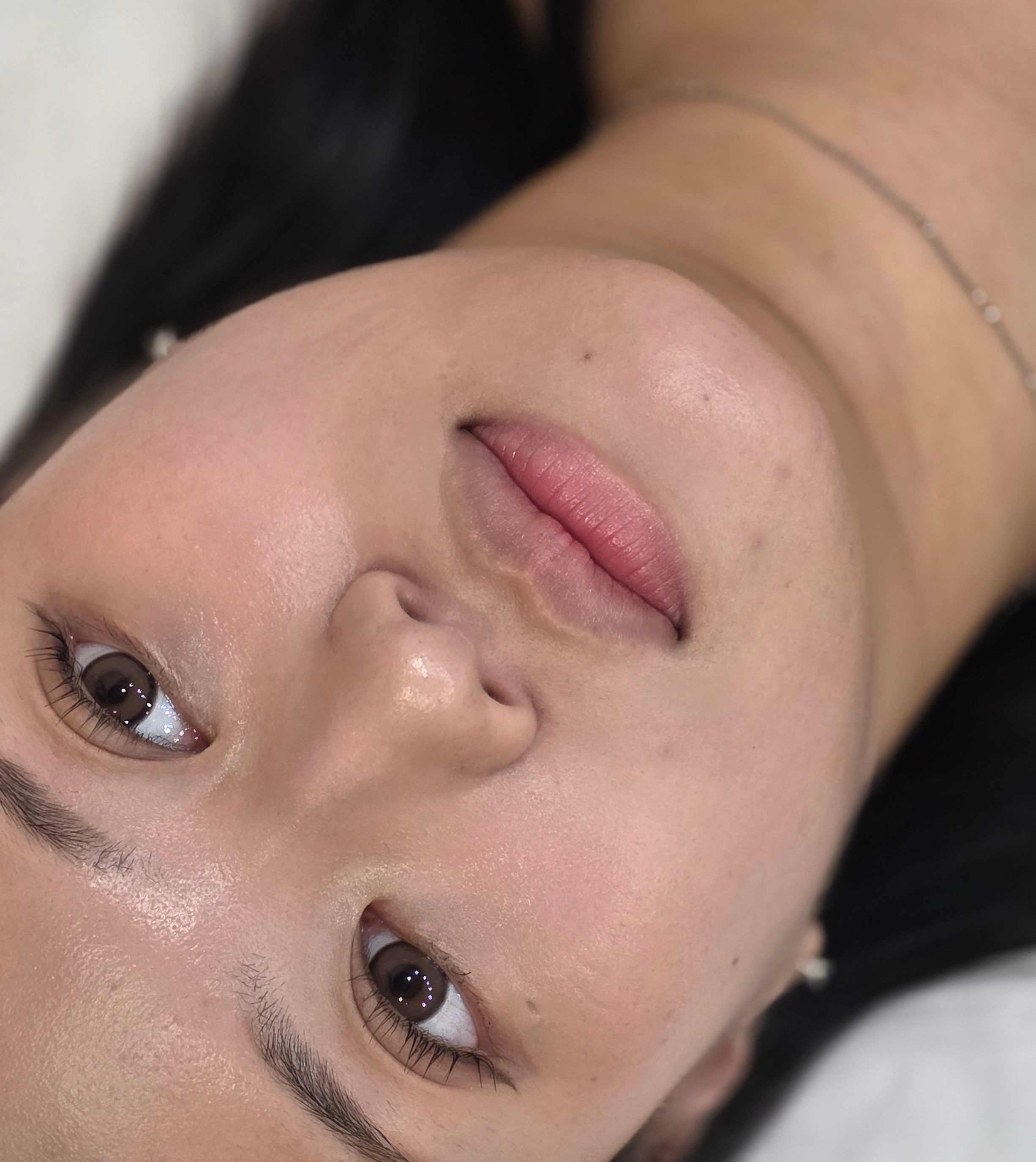 다크립 교정 비포