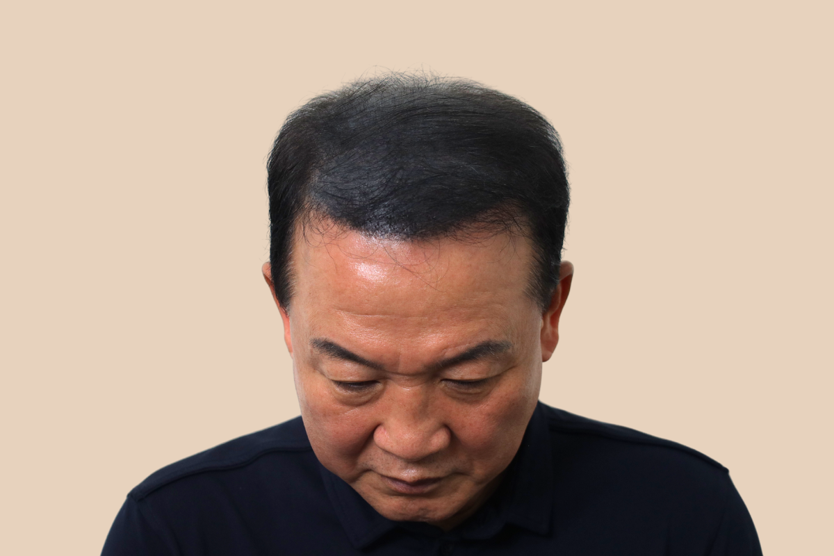 특수부위 시술 후