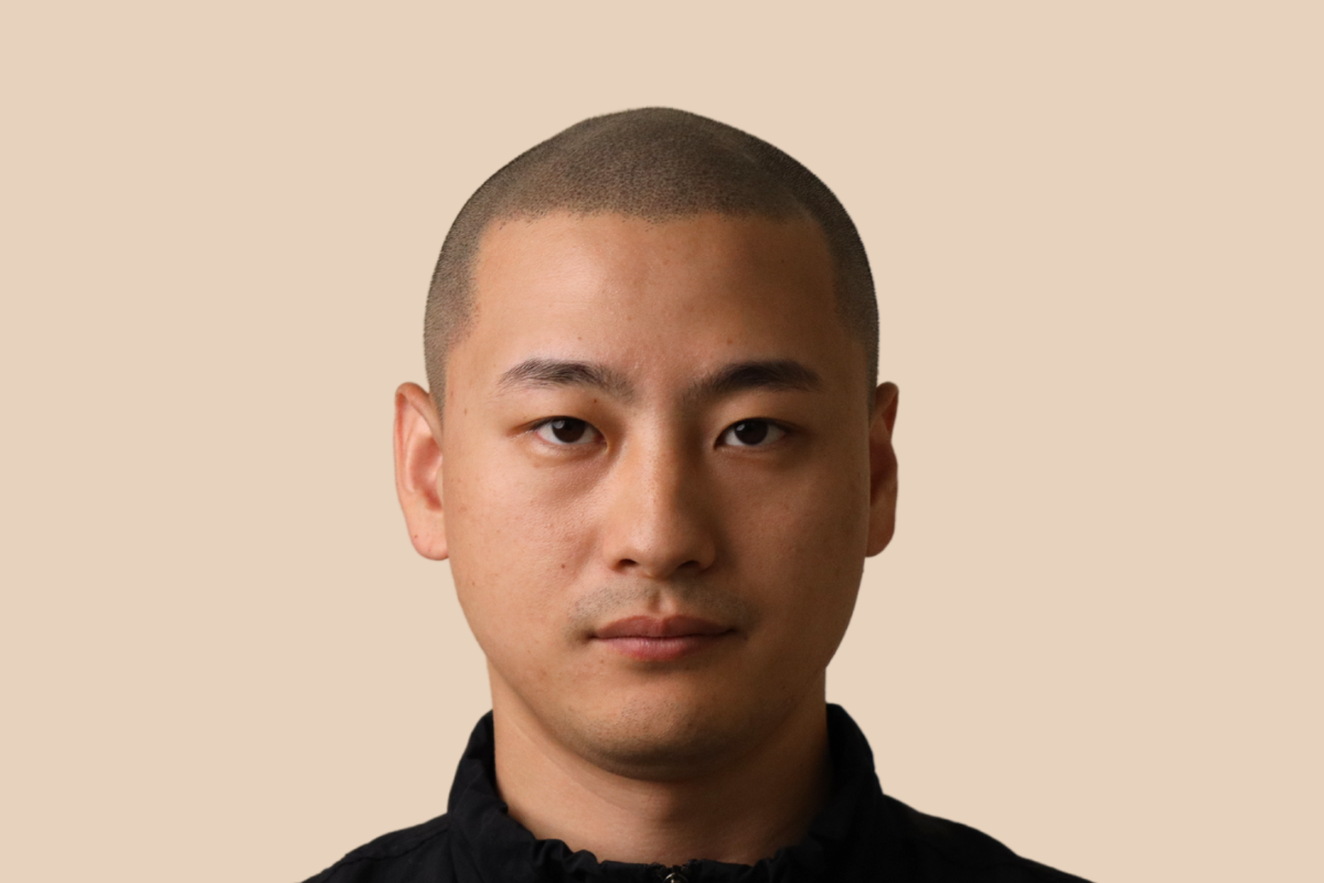 삭발디자인 5회 시술 후