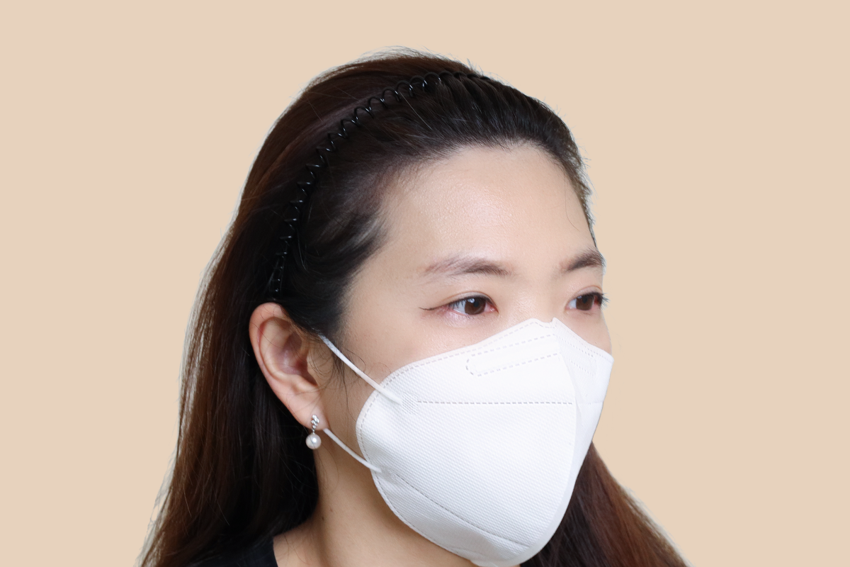 헤어라인 3회 시술 후
