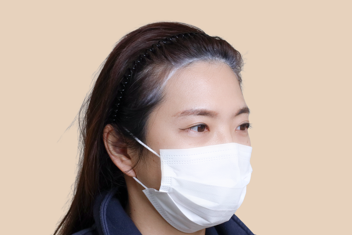 헤어라인 시술 전