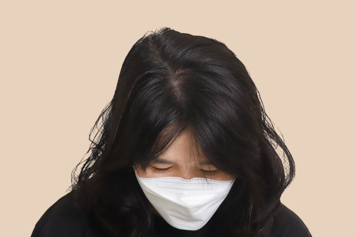 여성 두피문신 4회 시술 후