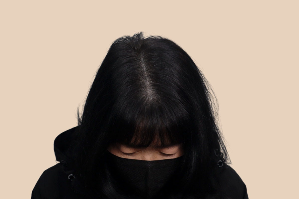 여성 두피문신 4회 시술 후