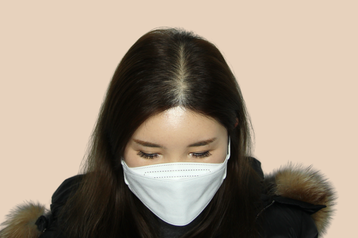 여성 두피문신 시술 전