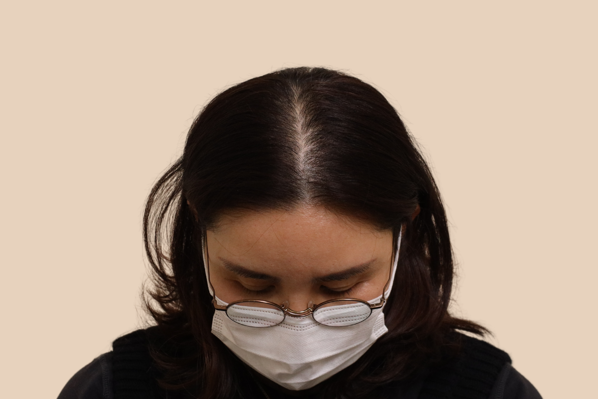 여성 두피문신 시술 전